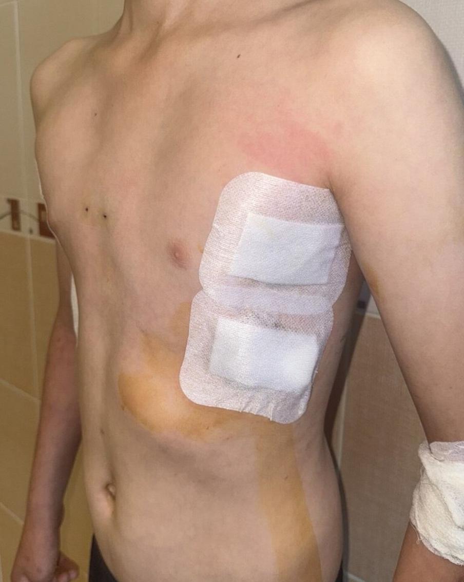 До, во время и после операции.