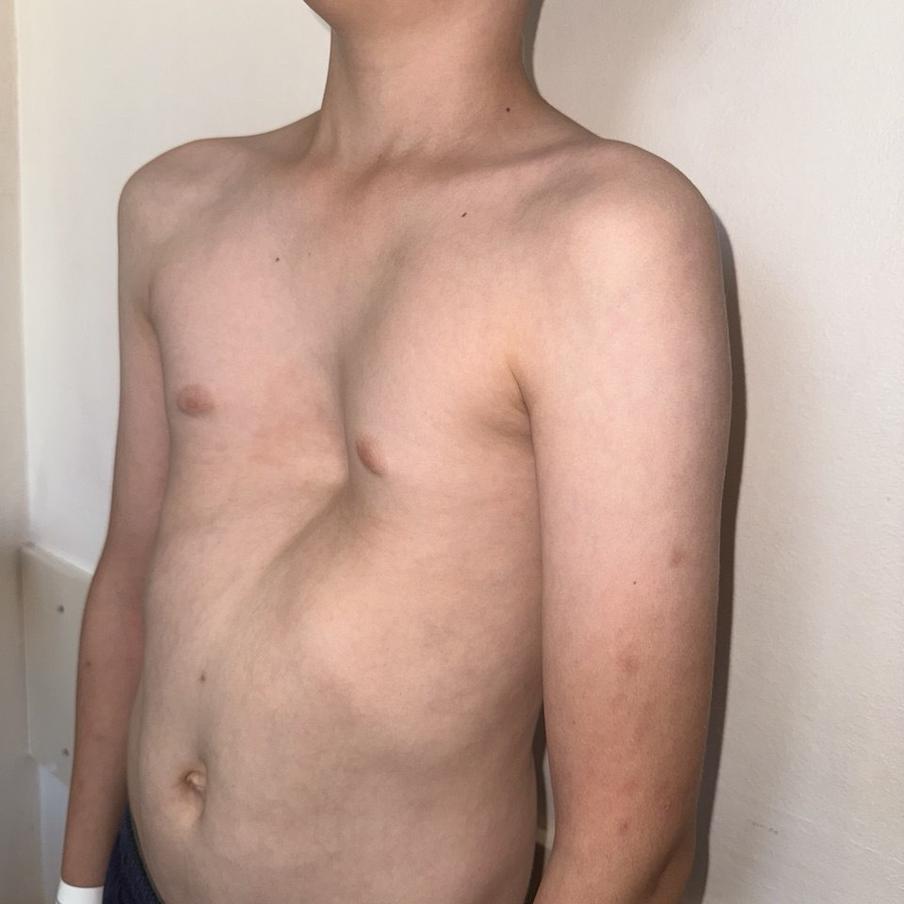 До, во время и после операции.