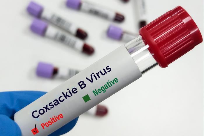 Российские туристы не могут выехать из Турции из-за помещения на карантин после заражения вирусом Коксаки