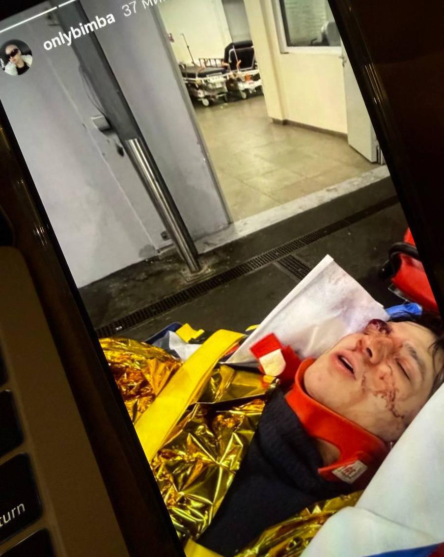 Стали известны подробности состояния упавшего с крыши в Париже рэпера Vacio