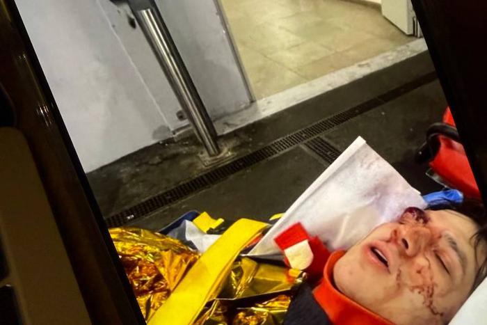 Стали известны подробности состояния упавшего с крыши в Париже рэпера Vacio