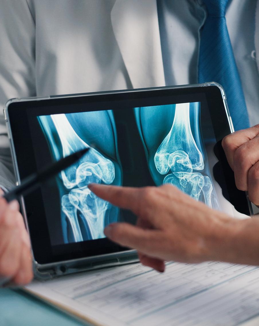 Что нужно знать об остеопорозе и как его предупредить: объясняют врачи