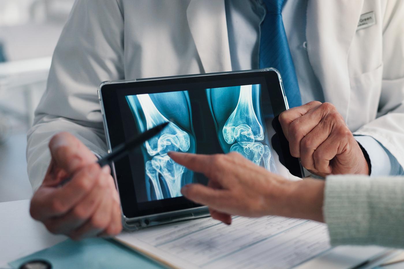 Кости могут сломаться даже от чиханья и тряски в транспорте: так выглядит остеопороз