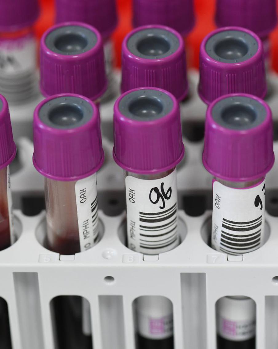 Минздрав: шесть миллионов россиян страдают сахарным диабетом