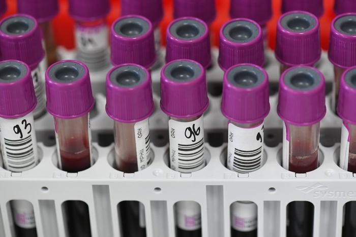 Минздрав: шесть миллионов россиян страдают сахарным диабетом