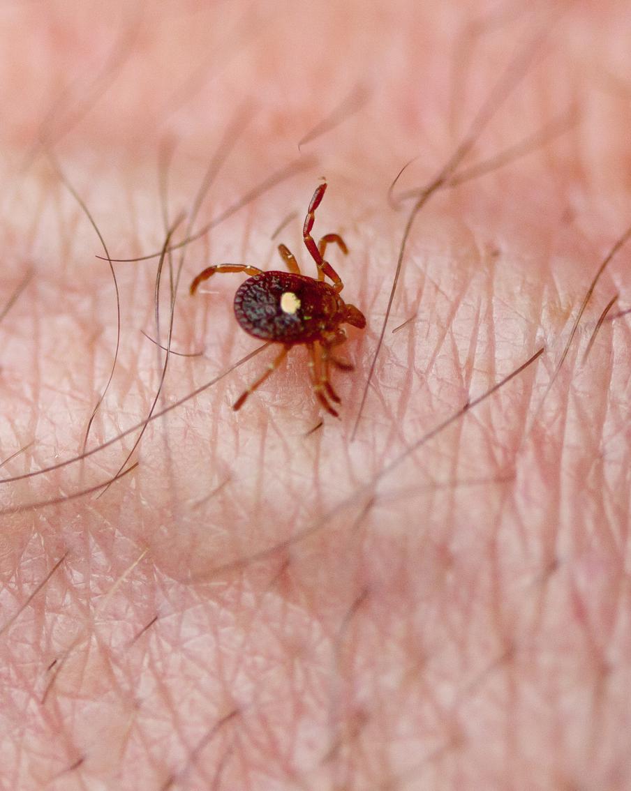 В США зафиксировали первую смерть человека, вызванную аллергией на мясо. В штате Нью-Джерси была зафиксирована первая смерть от аллергии на мясо. Уточняется, что она появилась у погибшего после укуса клеща-звездоноса, распространённого в некоторых частях США