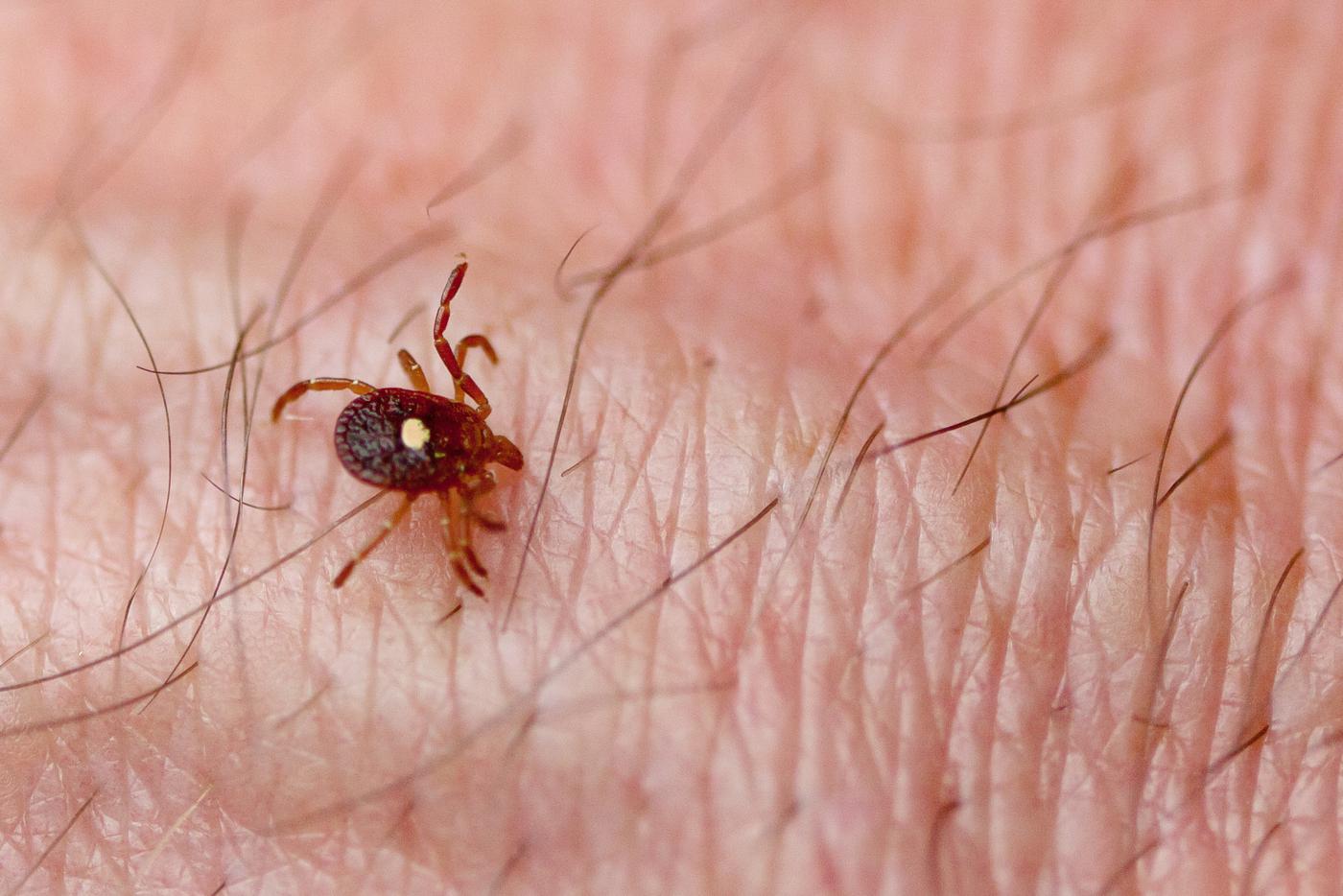 В США зафиксировали первую смерть человека из-за приступа аллергии на мясо