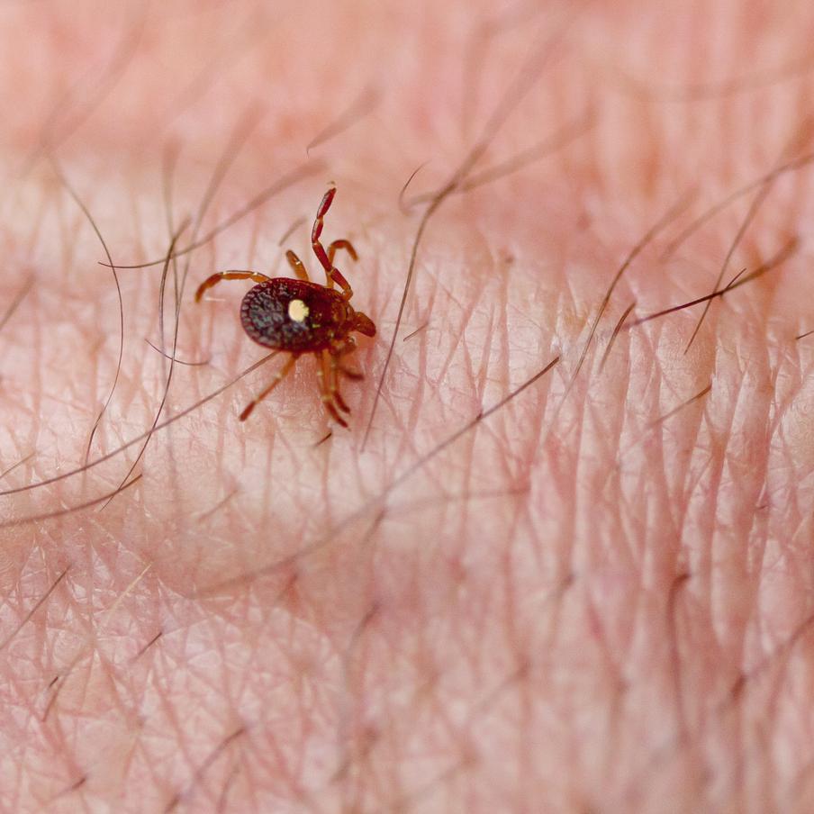 В США зафиксировали первую смерть человека, вызванную аллергией на мясо. В штате Нью-Джерси была зафиксирована первая смерть от аллергии на мясо. Уточняется, что она появилась у погибшего после укуса клеща-звездоноса, распространённого в некоторых частях США