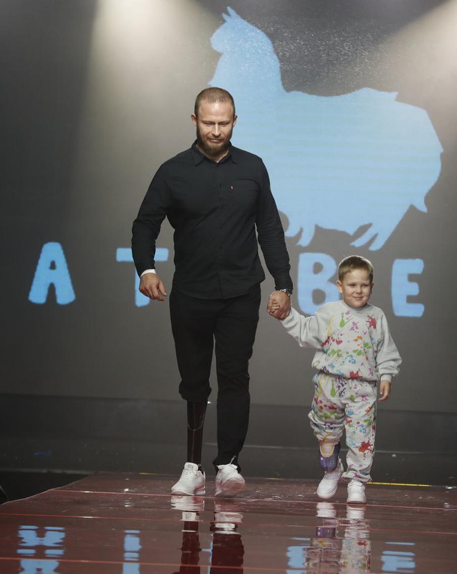 Дети на протезах показали безграничные возможности