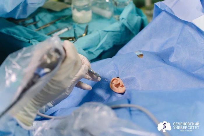 Пациентка Сеченовки рассказала, как ей создали перепонку из её же клеток