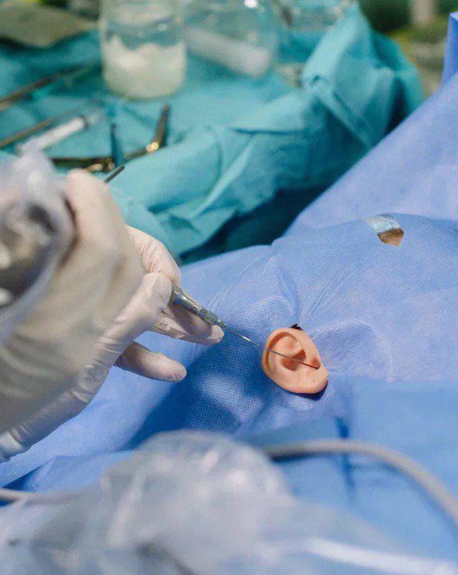 Пациентка Сеченовки рассказала, как ей создали перепонку из её же клеток