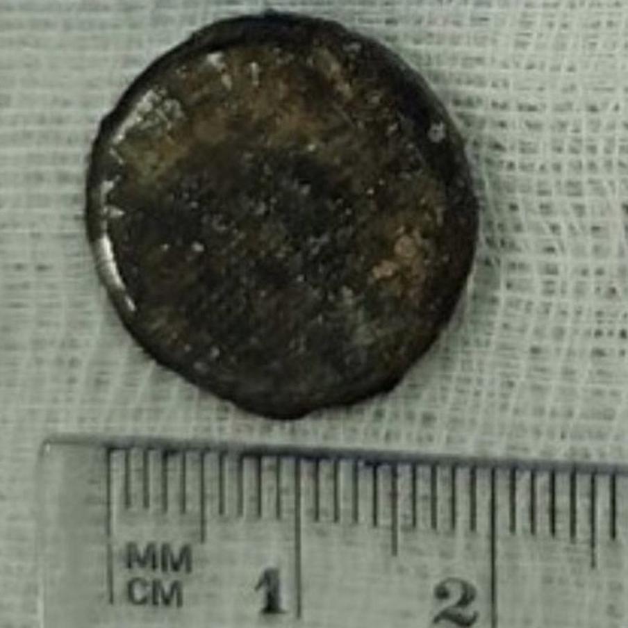 Батарейка опасна, она создает в пищеводе ожог.