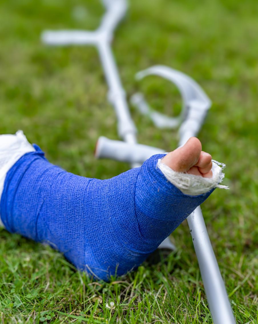 Ель, дрель, лосьон и собаки: что ещё мешало футболистам выйти на поле