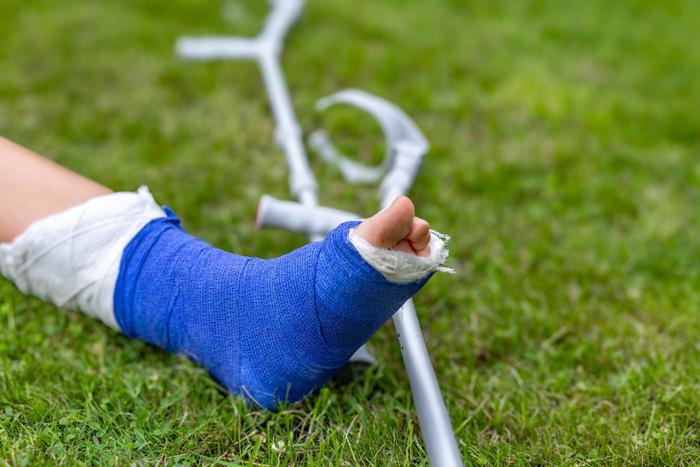 Ель, дрель, лосьон и собаки: что ещё мешало футболистам выйти на поле