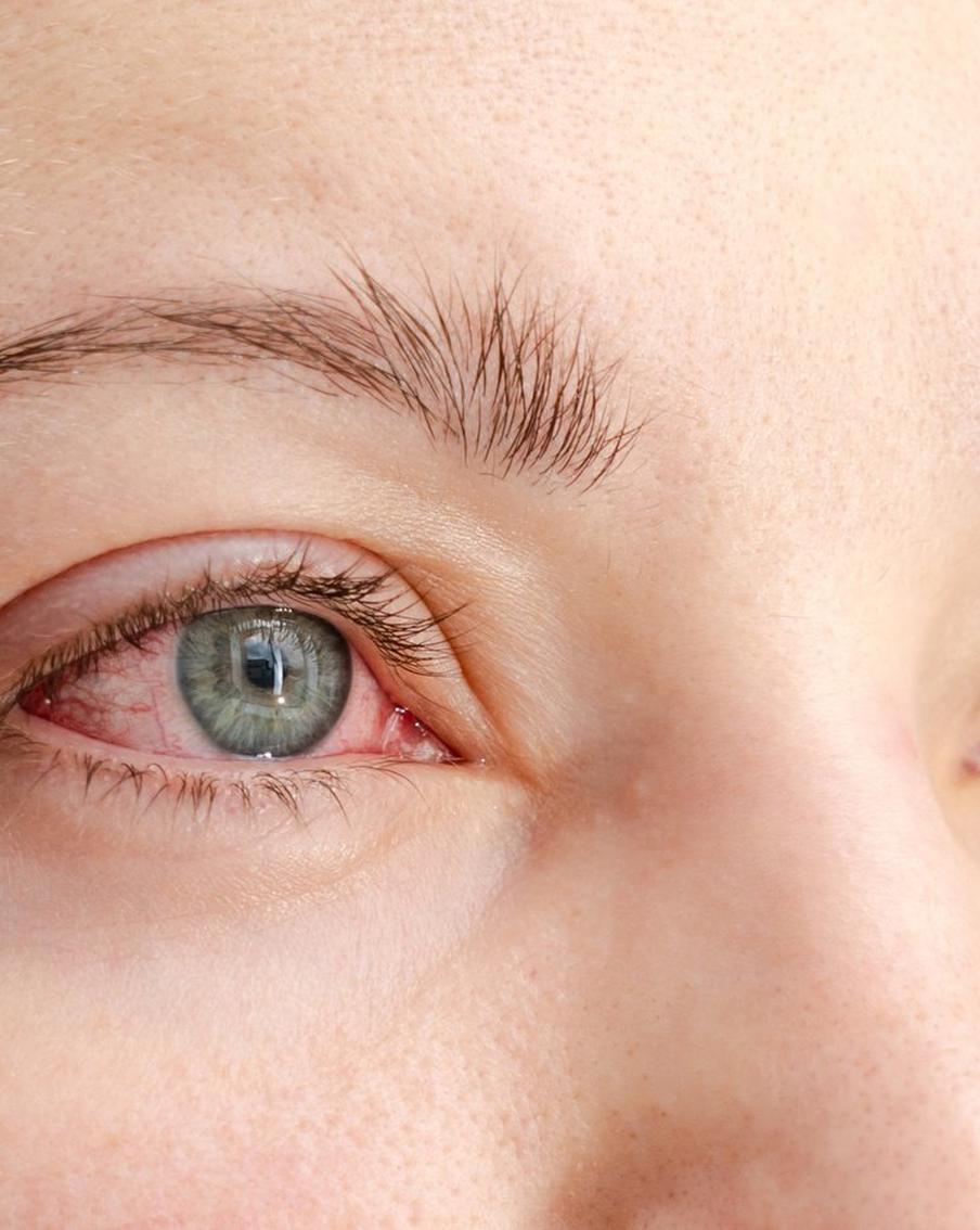 "Новый грипп ухудшает зрение" – эксперты рассказали, так ли это