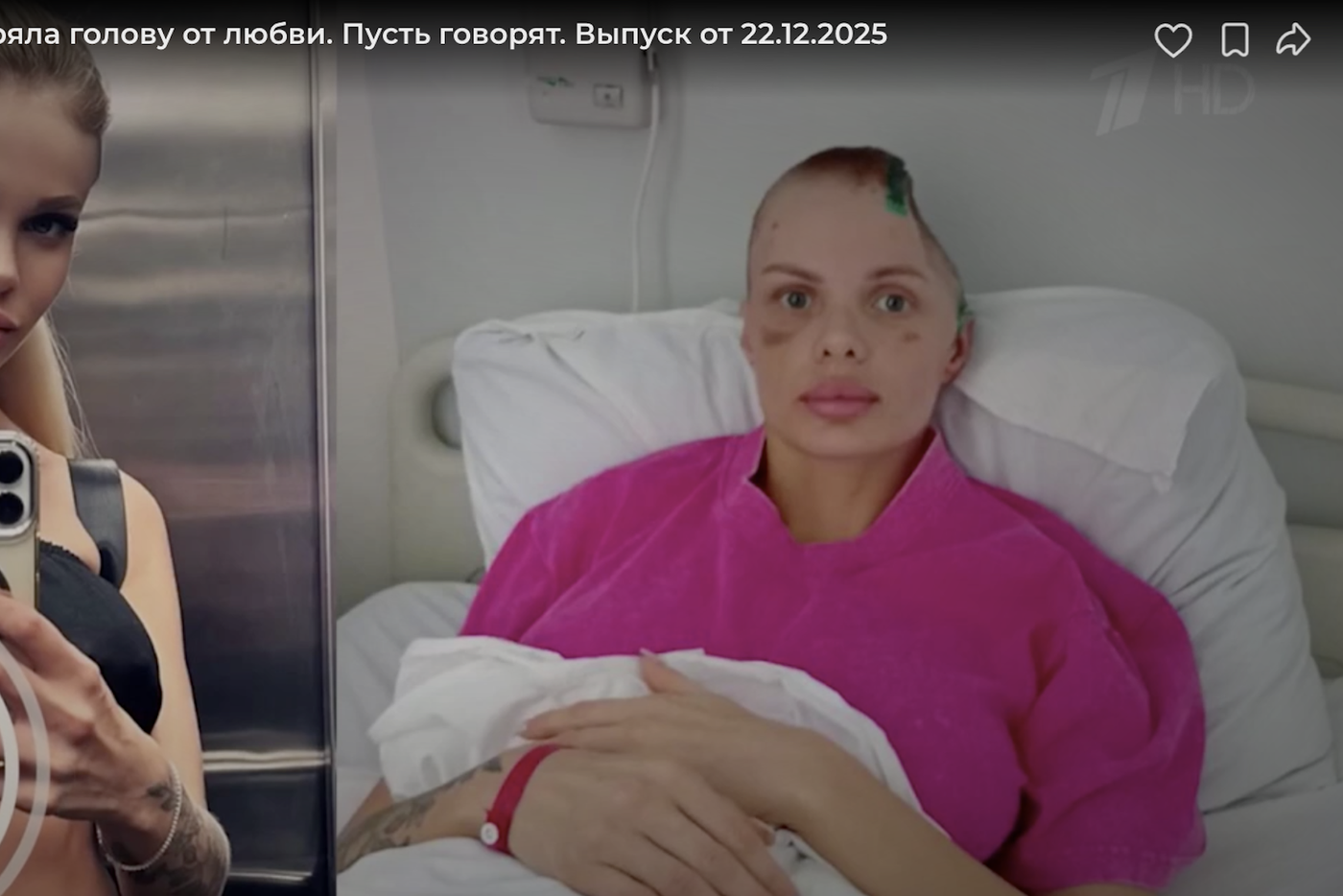 Как выглядела Тартанова, как выглядит сейчас