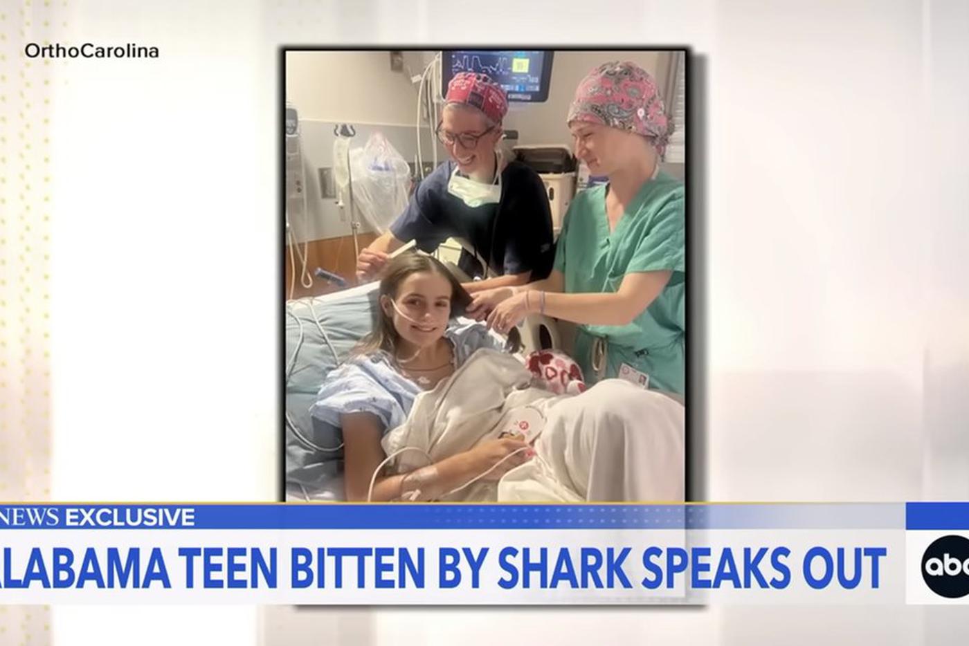 "Бог спас – доказываю, что не зря": акула лишила девушку руки и ноги