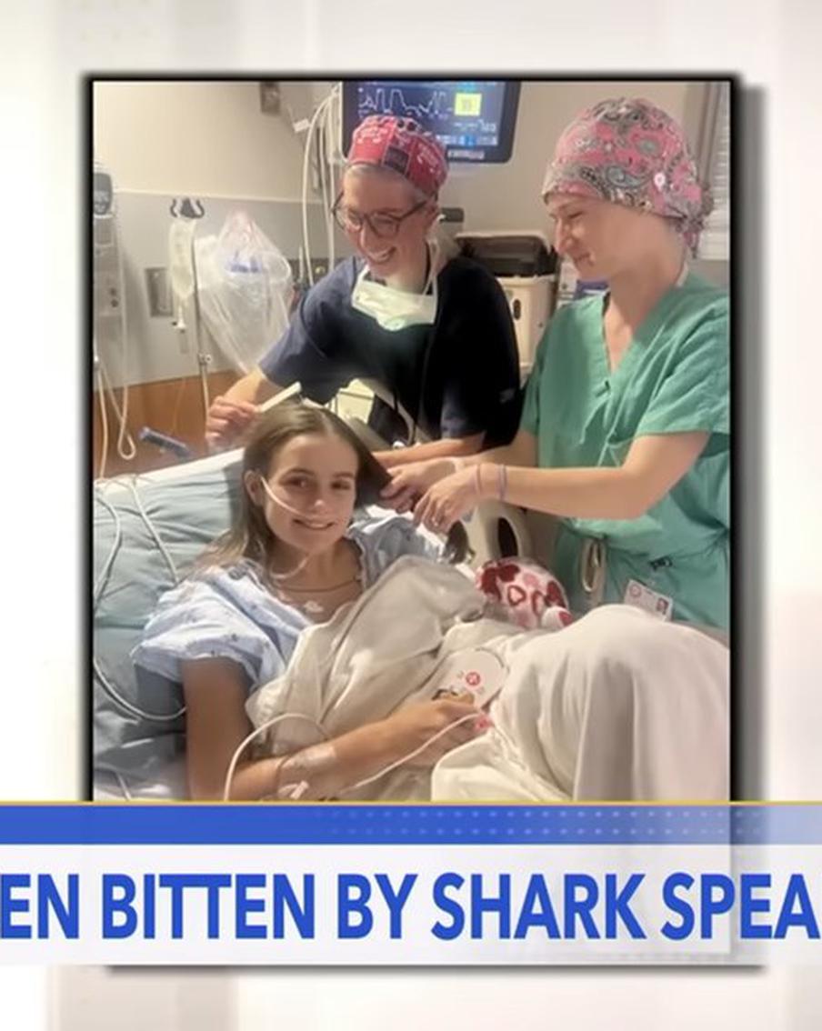 "Бог спас – доказываю, что не зря": акула лишила девушку руки и ноги