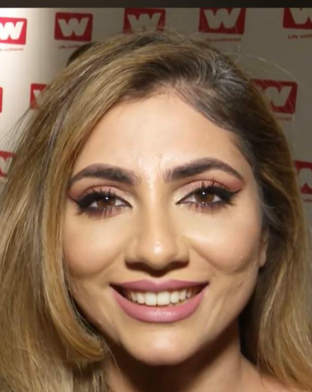 50 селфи в день состарили блогершу из Лондона. Как смартфоны портят нашу кожу?