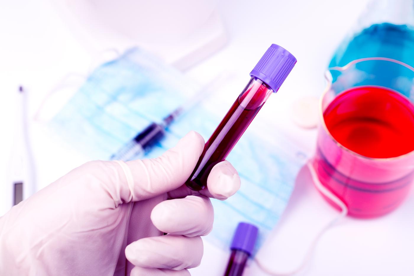 Власти Индии пытаются сдержать вспышку смертельного вируса Нипах в стране