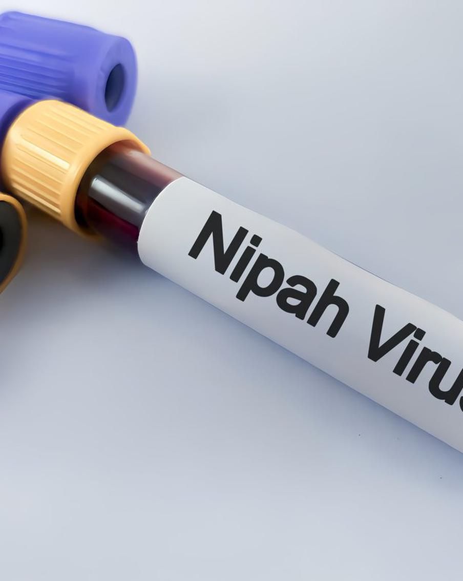 Инфекционист Шахмарданов: Вирус Нипах не представляет опасности для москвичей. Мурад Шахмарданов, доктор медицинских наук и профессор кафедры инфекционных болезней и эпидемиологии Института клинической медицины Пироговского университета, сообщил, что вирус Нипах, который был обнаружен в Индии, не представляет угрозы для жителей Москвы