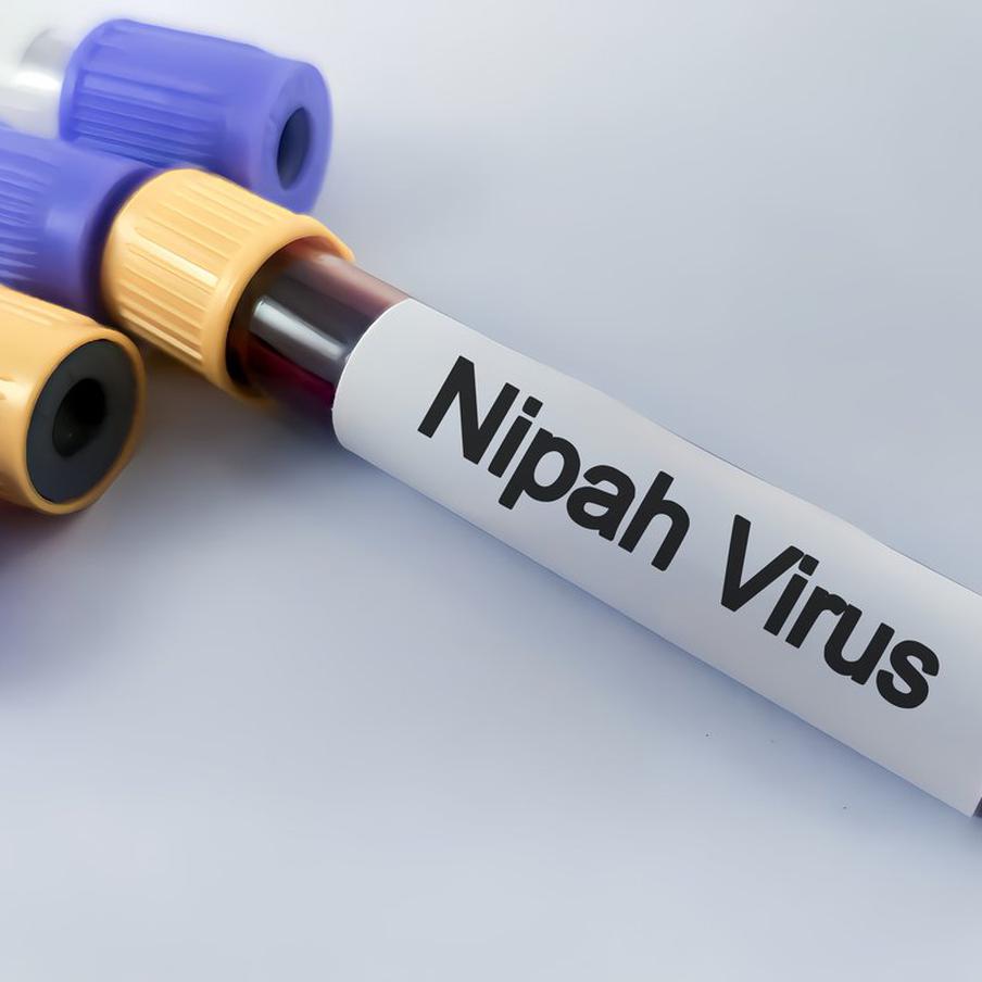 Инфекционист Шахмарданов: Вирус Нипах не представляет опасности для москвичей. Мурад Шахмарданов, доктор медицинских наук и профессор кафедры инфекционных болезней и эпидемиологии Института клинической медицины Пироговского университета, сообщил, что вирус Нипах, который был обнаружен в Индии, не представляет угрозы для жителей Москвы