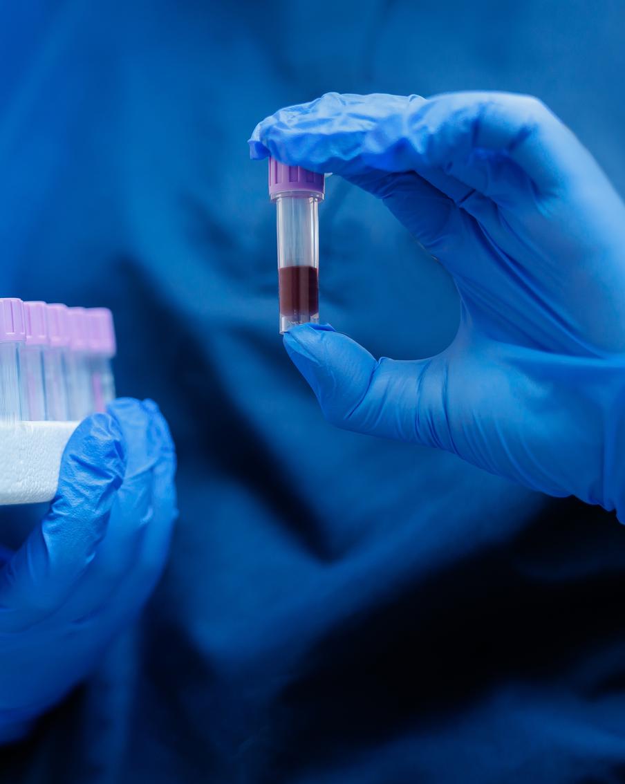 Роспотребнадзор заявил об отсутствии в России случаев заражения вирусом Нипах. Среди въезжающих в Россию граждан не было выявлено ни одного случая заболевания смертельным вирусом Нипах. Ситуация с инфекцией находится на контроле ведомства