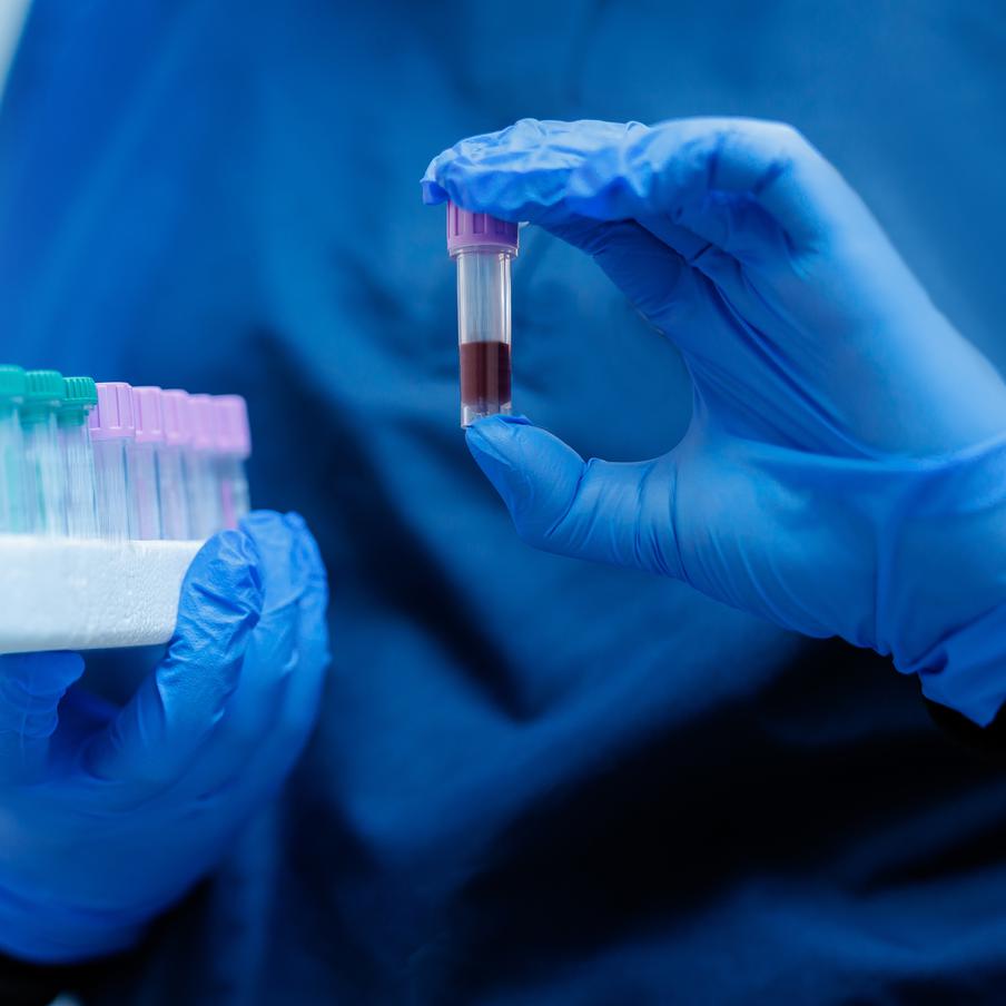 Роспотребнадзор заявил об отсутствии в России случаев заражения вирусом Нипах. Среди въезжающих в Россию граждан не было выявлено ни одного случая заболевания смертельным вирусом Нипах. Ситуация с инфекцией находится на контроле ведомства