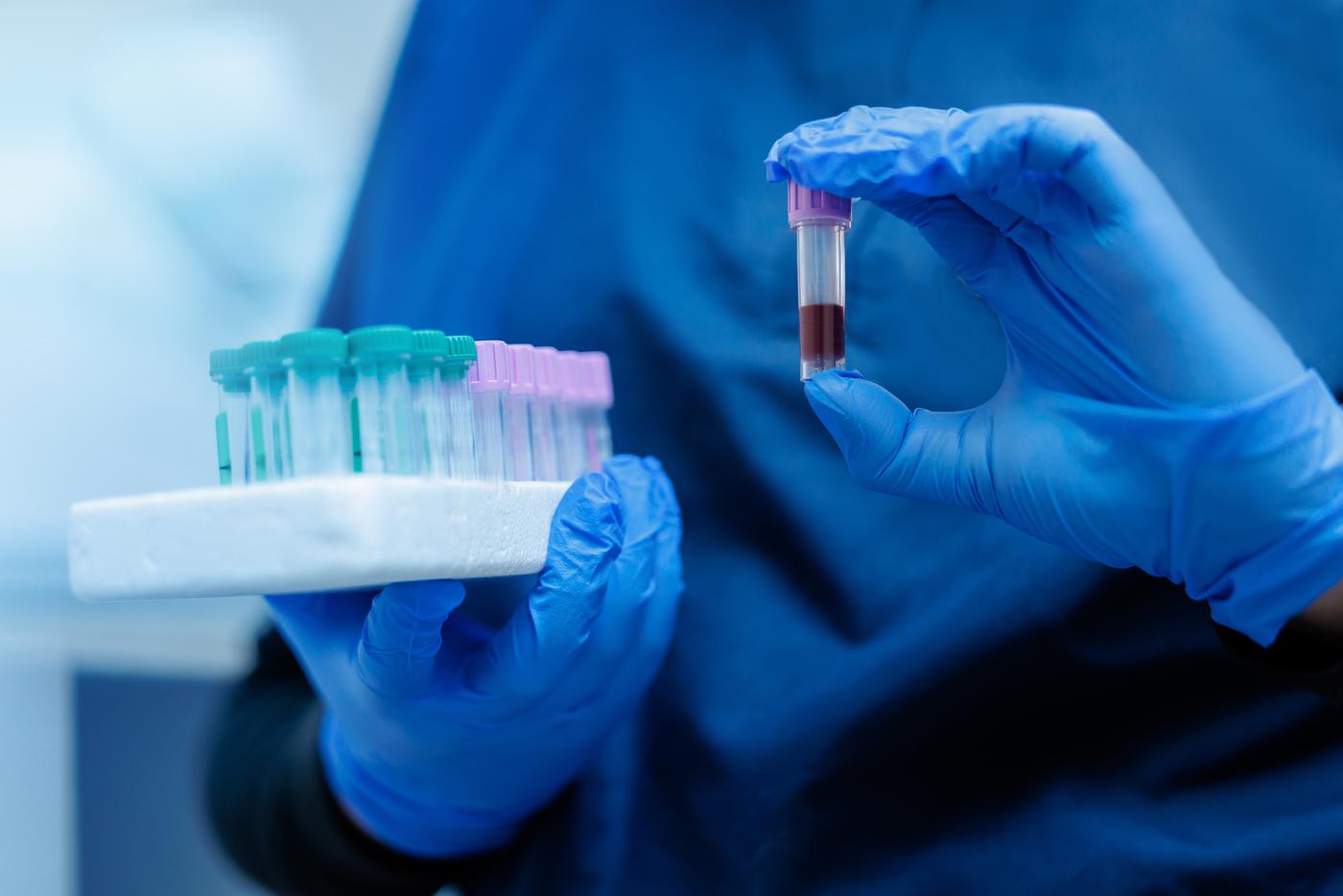 Роспотребнадзор заявил об отсутствии в России случаев заражения вирусом Нипах