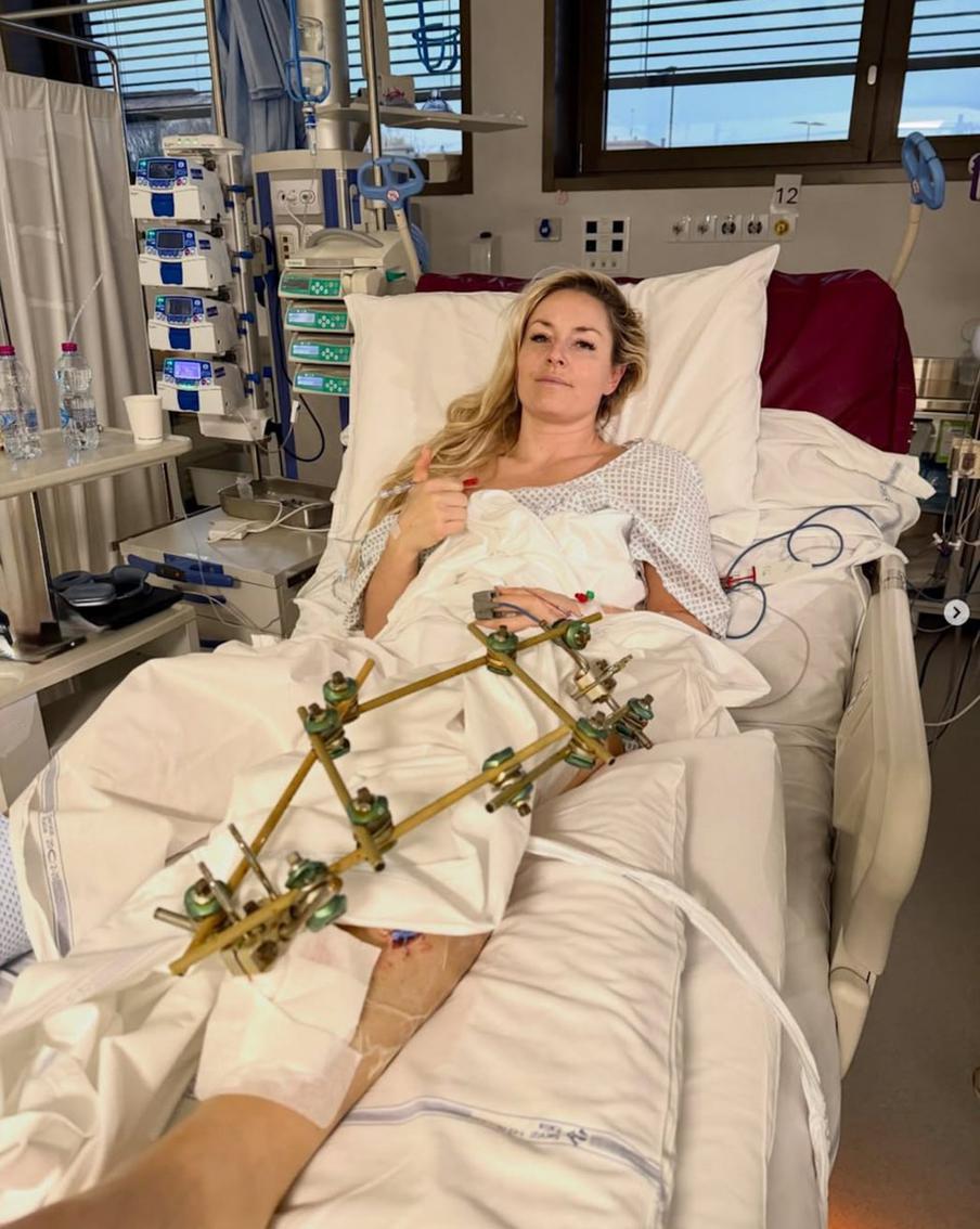 Линдси Вонн может грозить ампутация ноги после падения на Олимпиаде