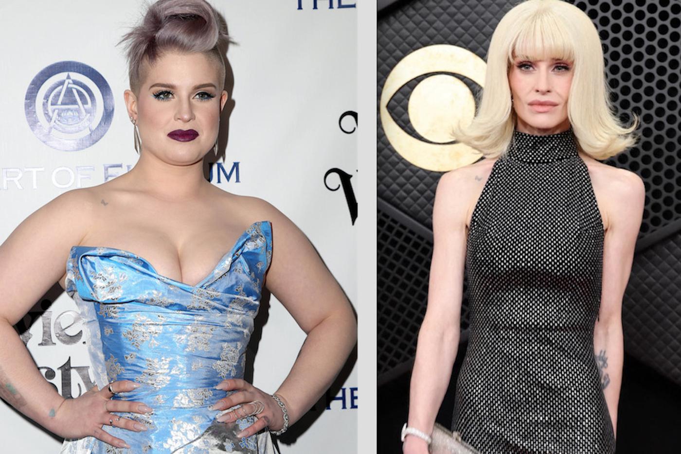 Просто не узнать: как Келли Осборн, Светлана Пермякова, Эми Шумер смогли похудеть