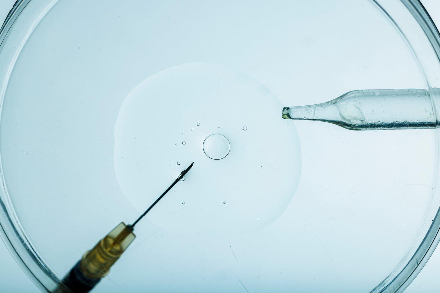 В нидерландском Арнеме гинеколог тайно стал отцом минимум 16 детей