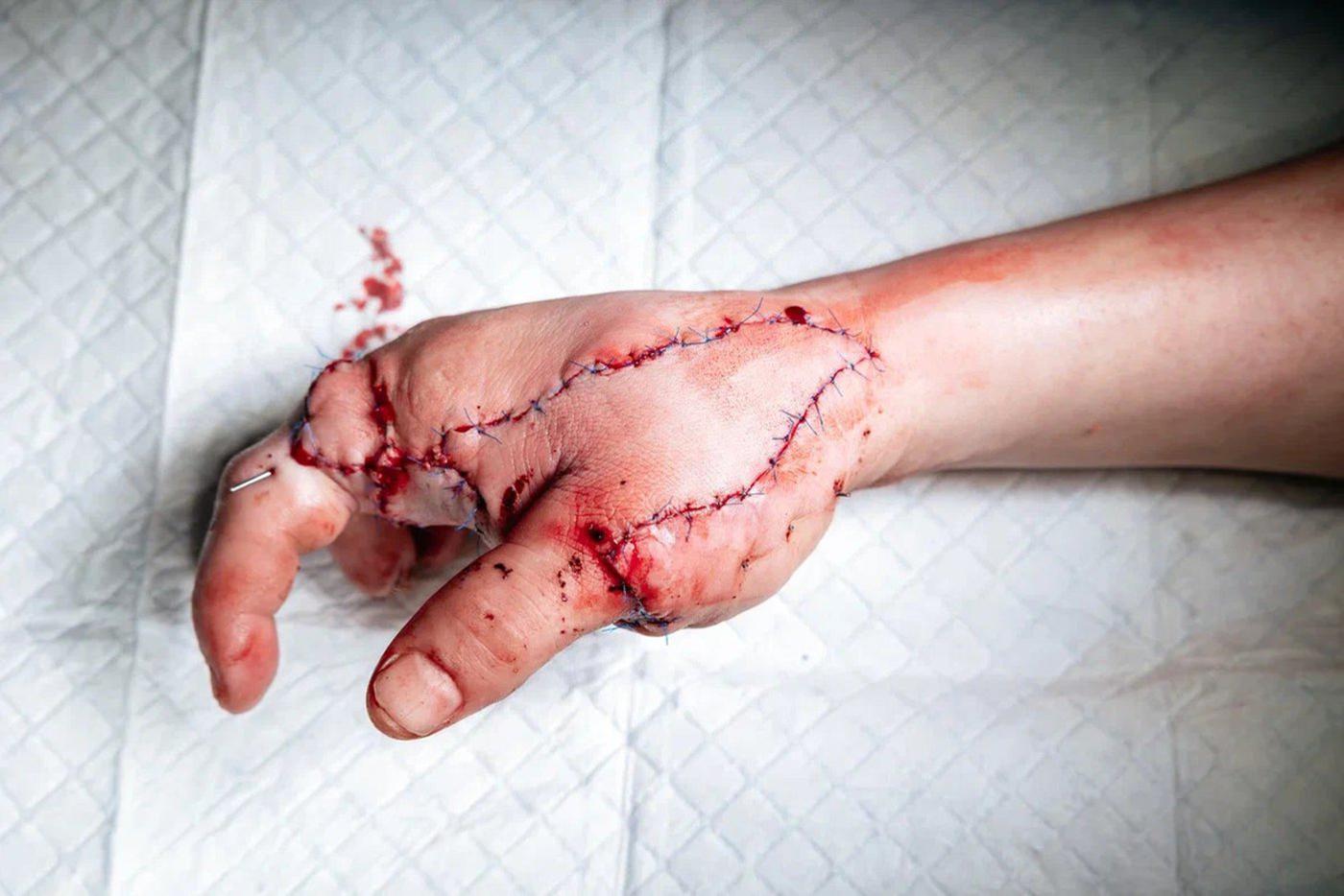 Каждый сосуд и каппиляр необходимо соединить