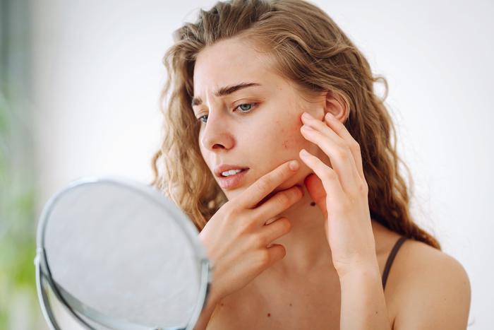 Аллергия или дерматит: как распознать и как успокоить раздражённую кожу