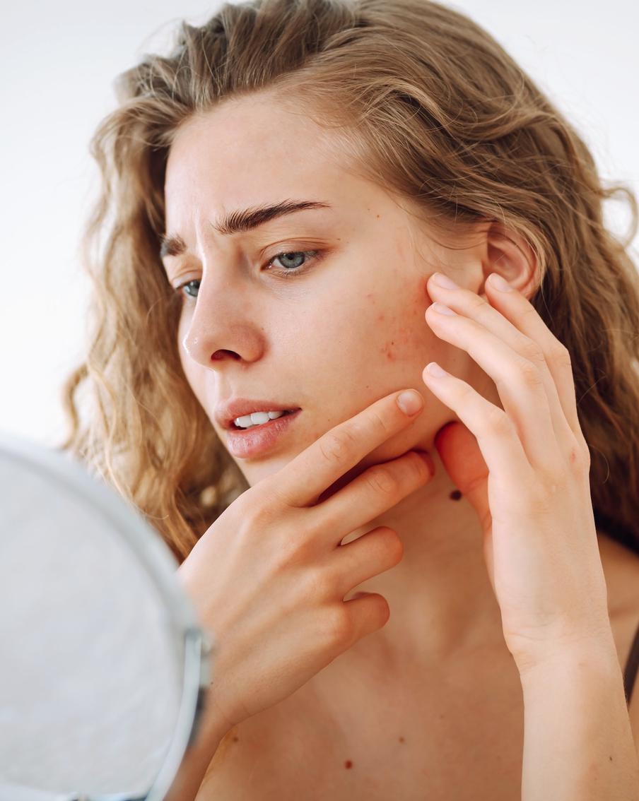 Аллергия или дерматит: как распознать и как успокоить раздражённую кожу