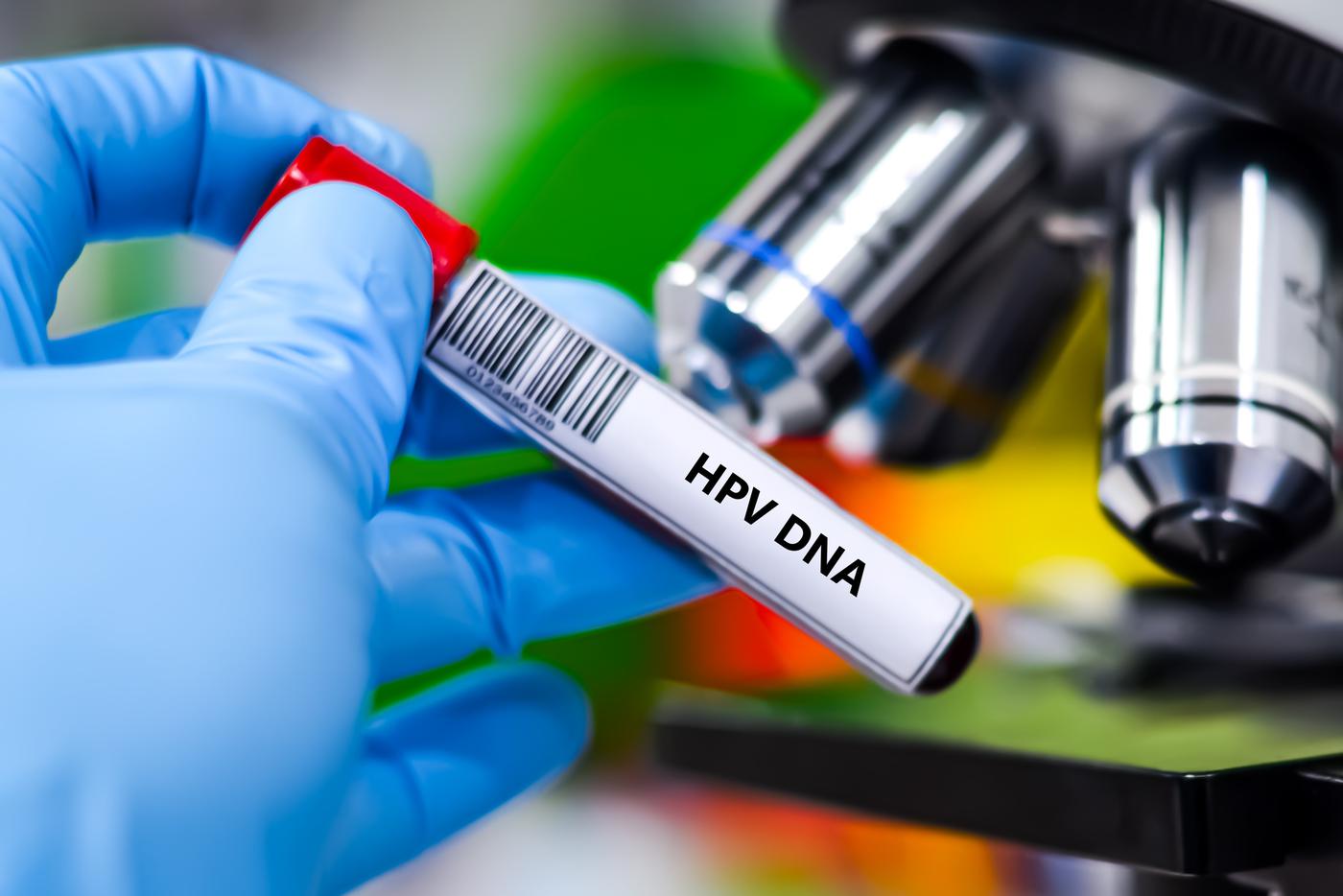 Ранняя диагностика рака: анализ на ВПЧ стал доступен на диспансеризации