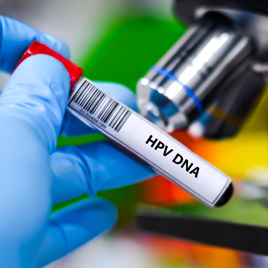 Анализ на ВПЧ включили в первый этап диспансеризации для россиянок. Женщины от 21 до 49 лет теперь смогут проходить тестирование на вирус папилломы человека высокого канцерогенного риска в рамках профилактических осмотров. При положительном результате исследования будут проводиться ежегодно