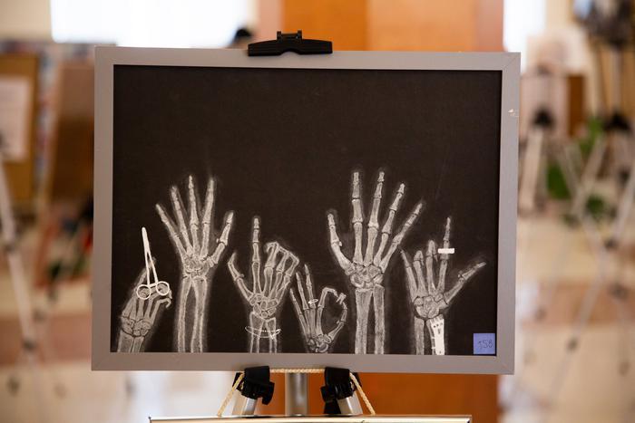 Кости, органы, масло и пастель: зачем в век цифровых технологий медики делают анатомические рисунки от руки