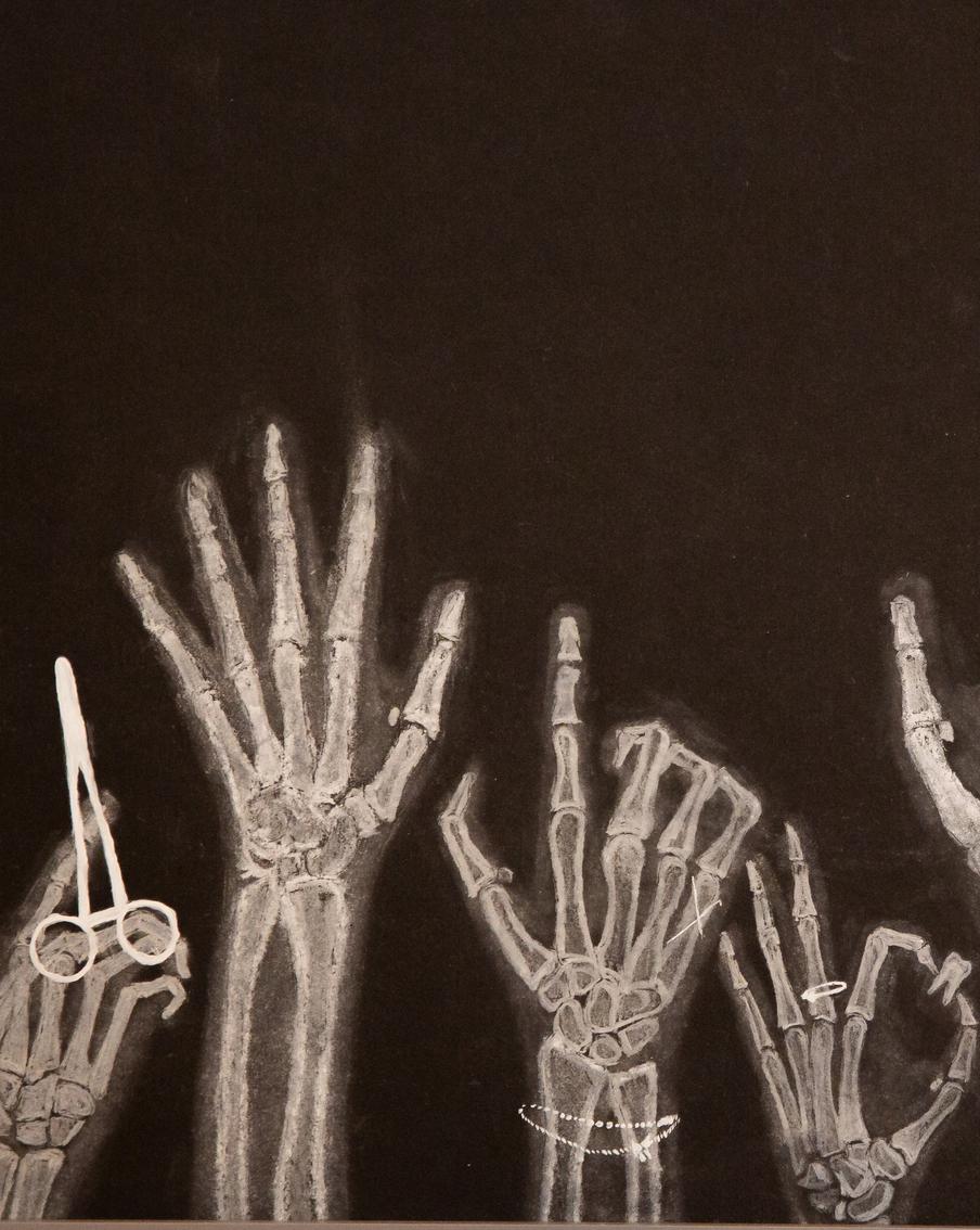 Кости, органы, масло и пастель: зачем в век цифровых технологий медики делают анатомические рисунки от руки