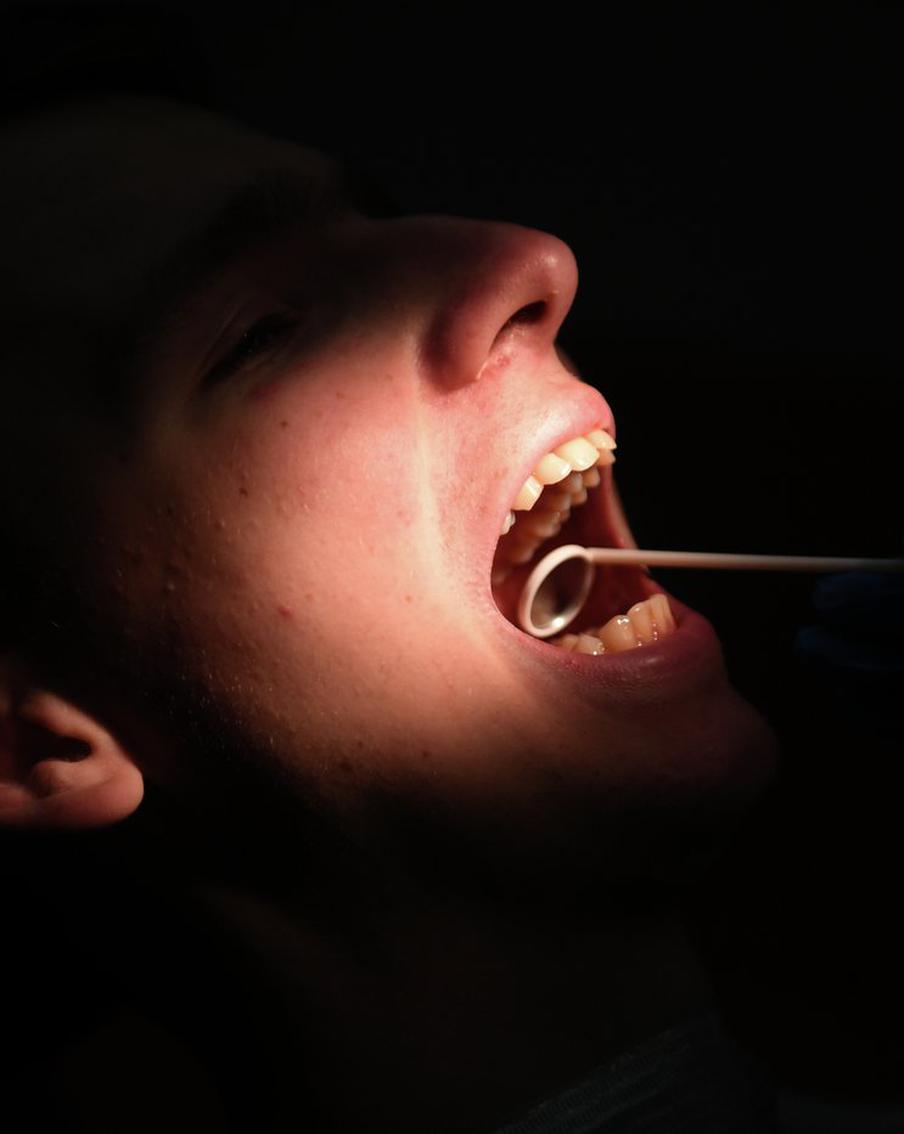 В Подмосковье врачи спасли пациента, который проглотил стоматологический бур. Мужчина обратился за помощью после того, как во время лечения в частной клинике инородное тело попало в дыхательные пути. Острый инструмент обнаружили в левом бронхе, требовалась срочная операция