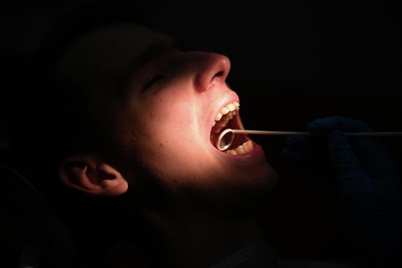 Подмосковные врачи спасли пациента, проглотившего бур во время лечения зубов