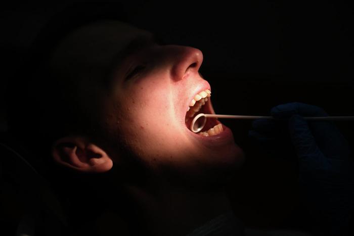 Подмосковные врачи спасли пациента, проглотившего бур во время лечения зубов