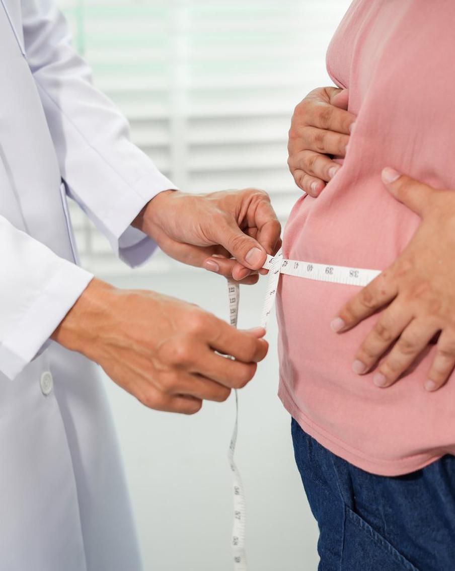 Лишний вес удалят хирургическим путём по полису ОМС