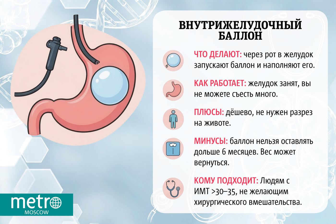 Инфографика