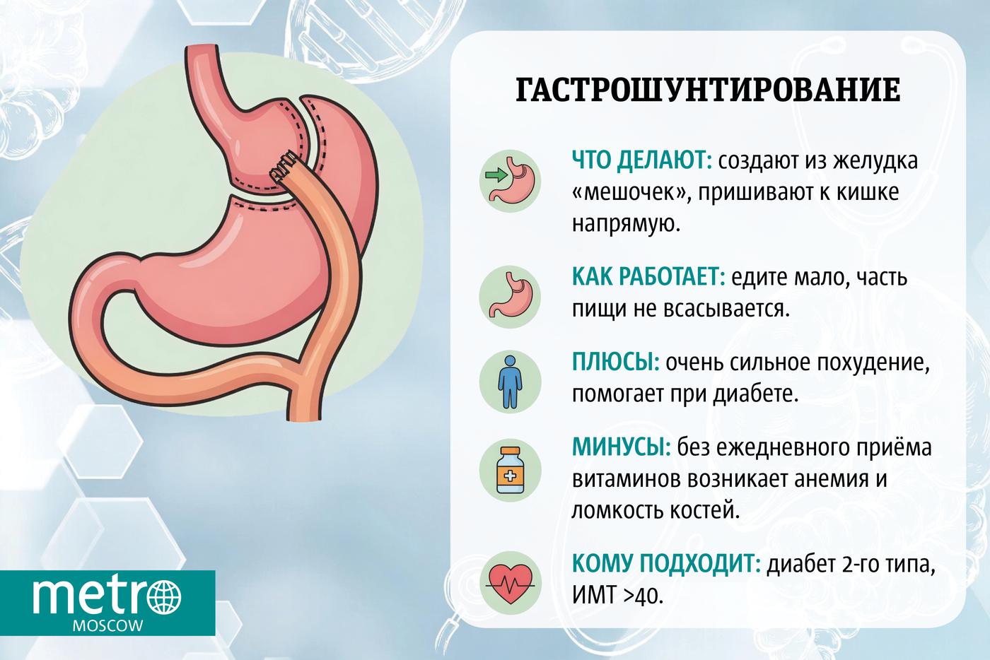 Инфографика