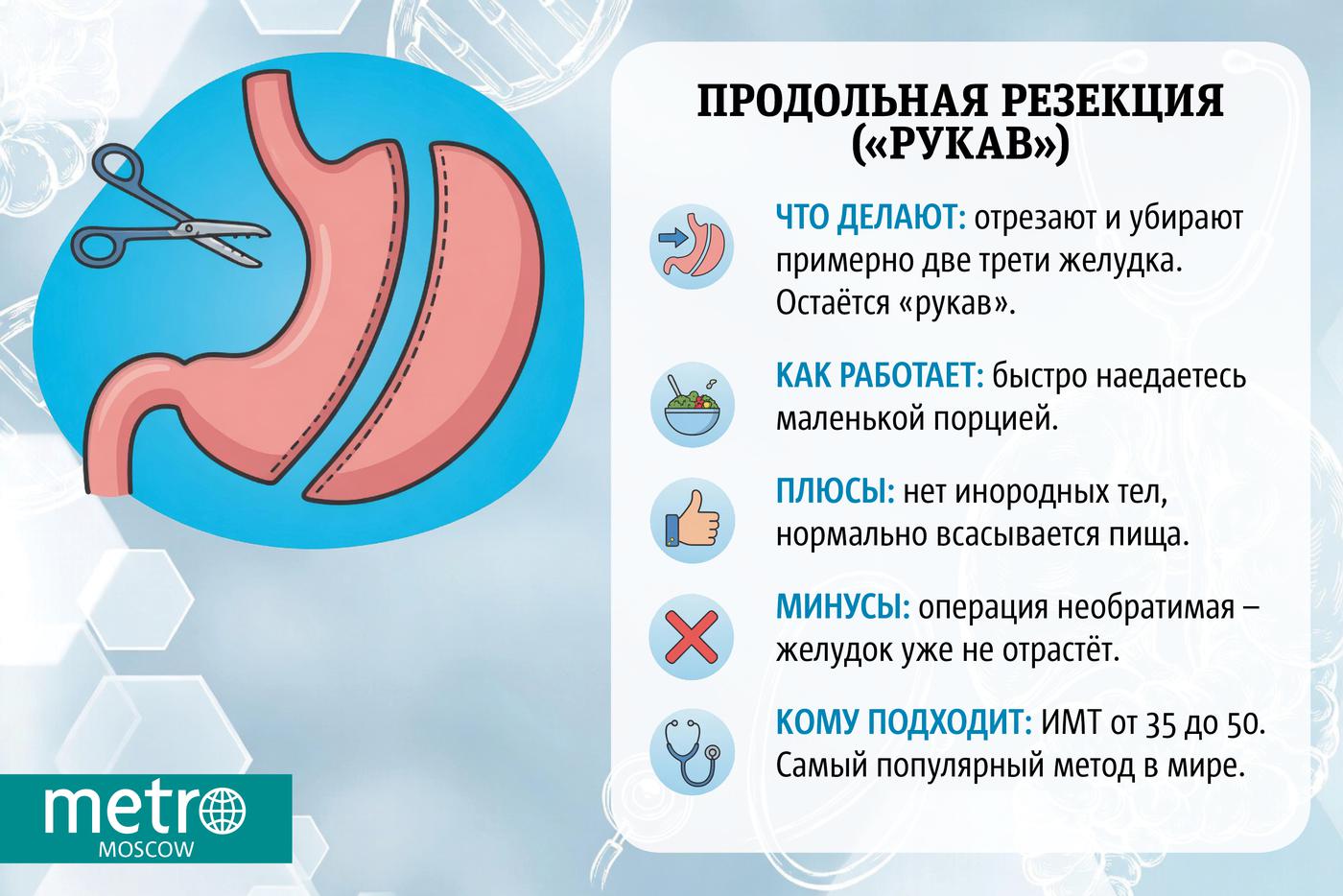 Инфографика