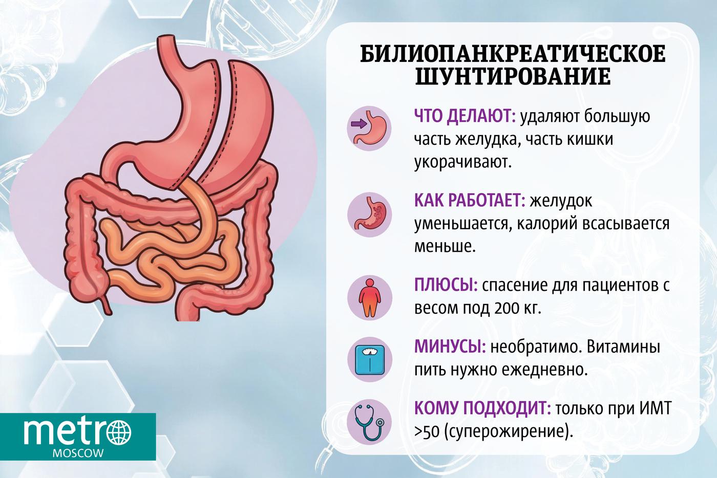 Инфографика
