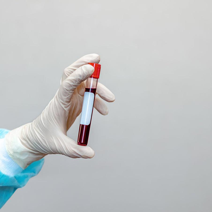 Заболеваемость ВИЧ в России сократилась вдвое за 10 лет. По сообщению пресс-службы Министерства здравоохранения Российской Федерации, с 2016 года количество людей, у которых был диагностирован ВИЧ в России, сократилось вдвое, достигнув исторического минимума