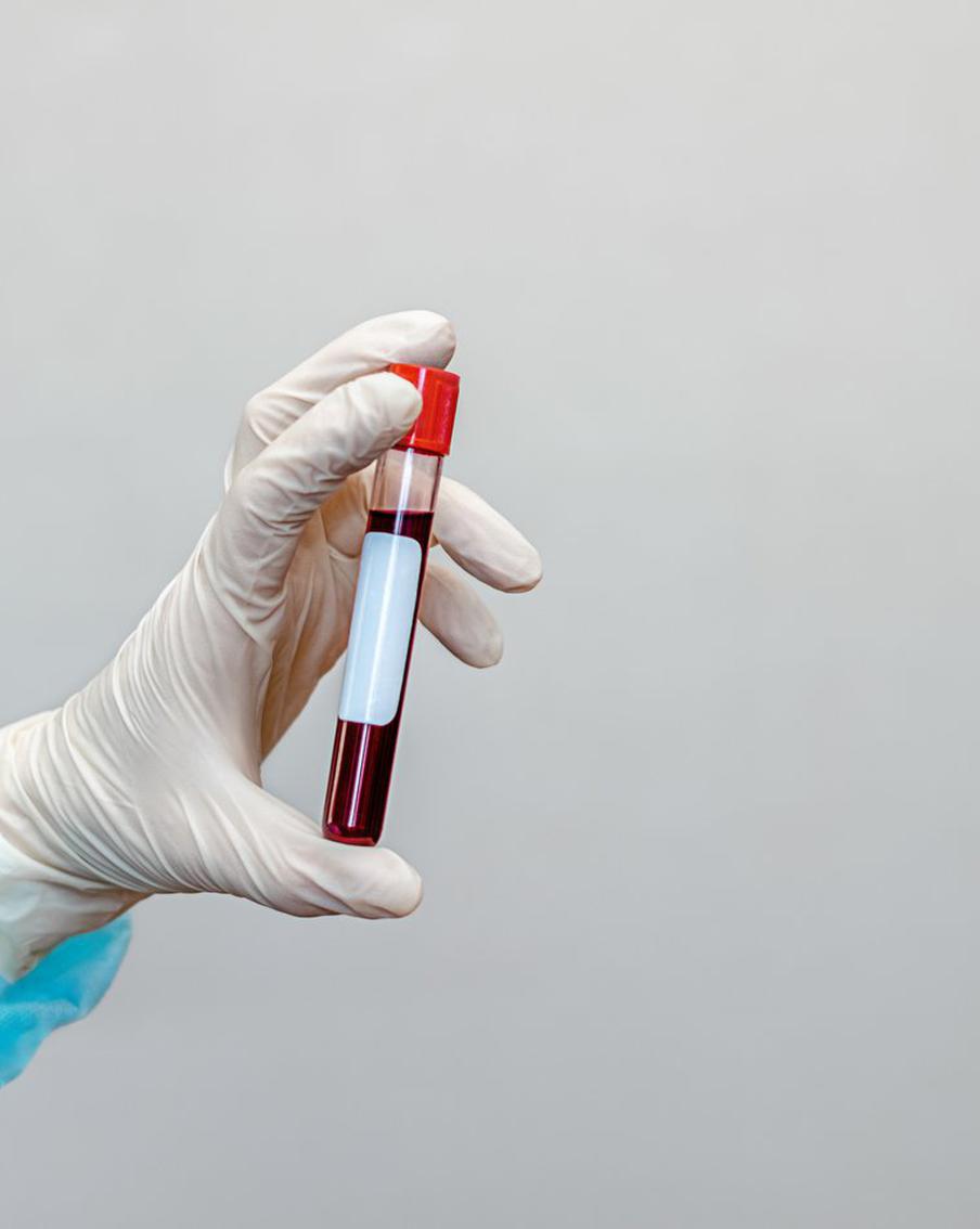 Заболеваемость ВИЧ в России сократилась вдвое за 10 лет. По сообщению пресс-службы Министерства здравоохранения Российской Федерации, с 2016 года количество людей, у которых был диагностирован ВИЧ в России, сократилось вдвое, достигнув исторического минимума